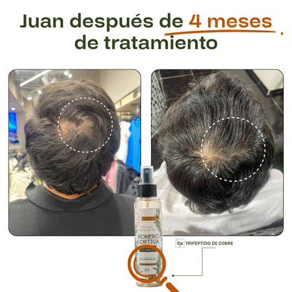 4x Tónico Anticaída - Tratamiento Completo 16 Semanas