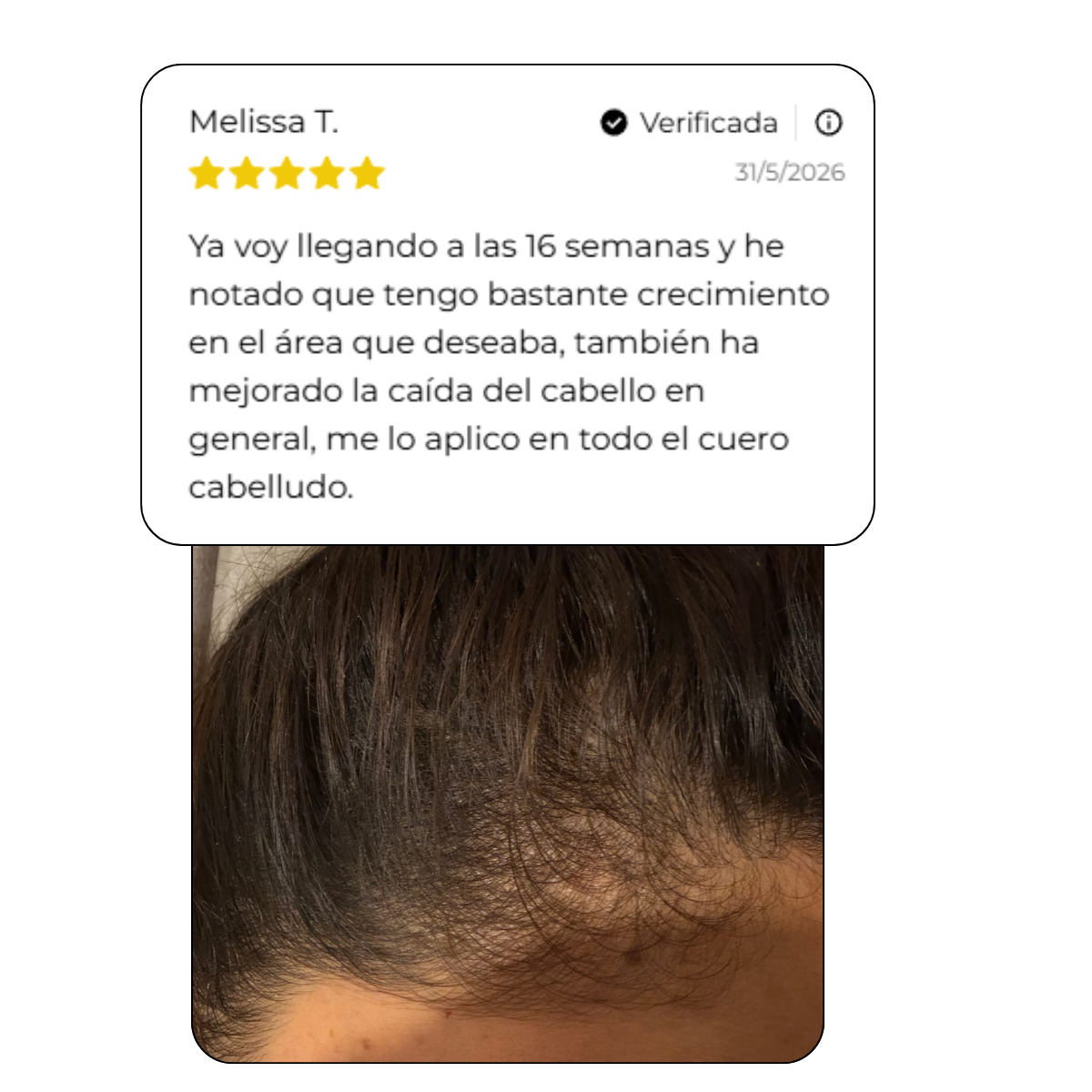 Kit Fuerza y Nutrición Capilar | ENVIO GRATIS