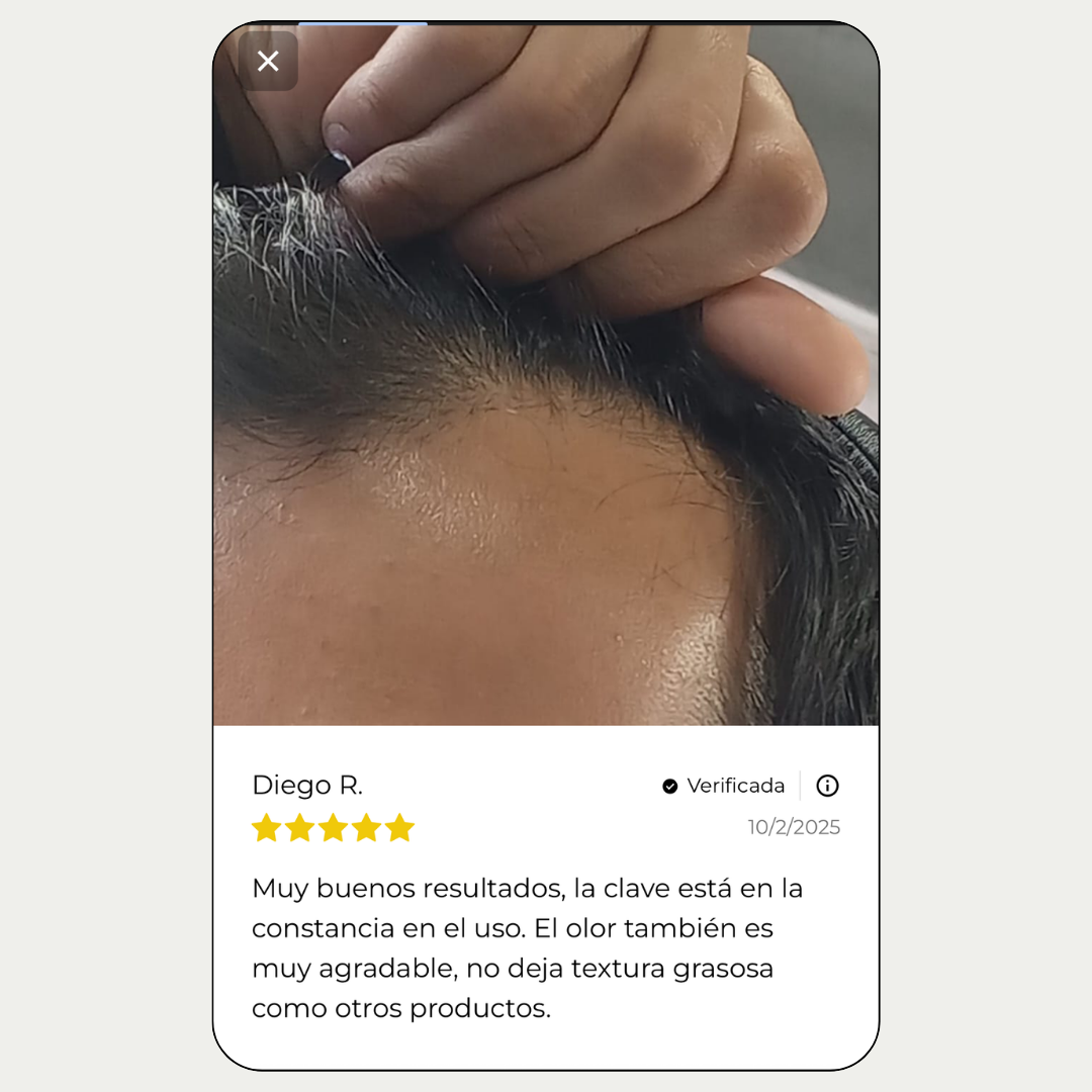 Tónico Capilar de Romero · Crecimiento y Anticaída + Dermaroller de regalo