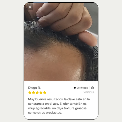 Tónico Capilar de Romero · Crecimiento y Anticaída + Dermaroller de regalo