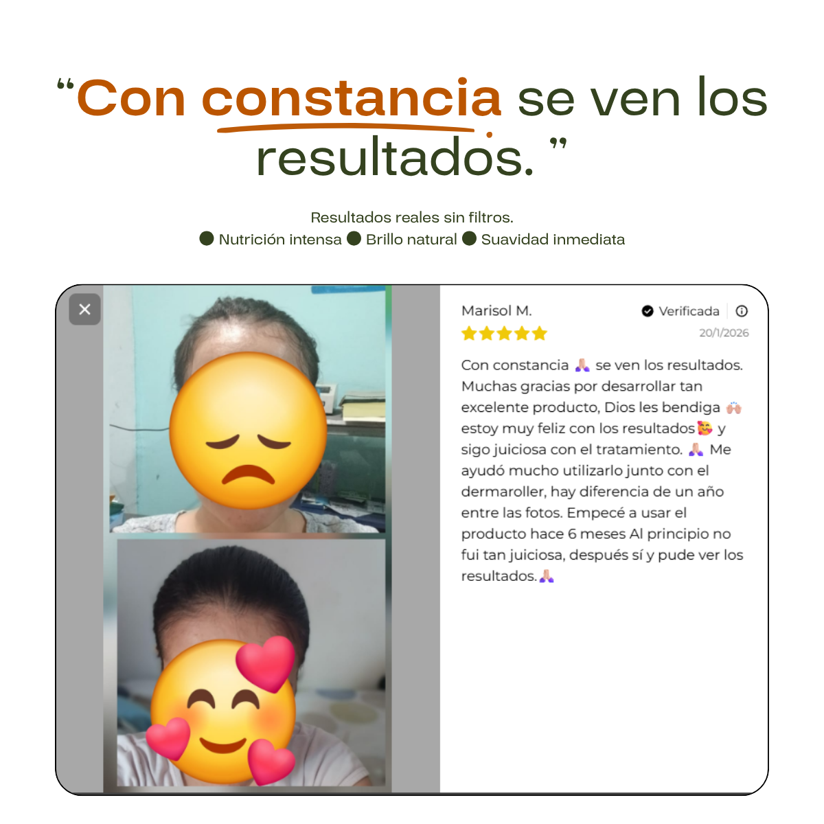 4x Tónico Anticaída - Tratamiento Completo 16 Semanas
