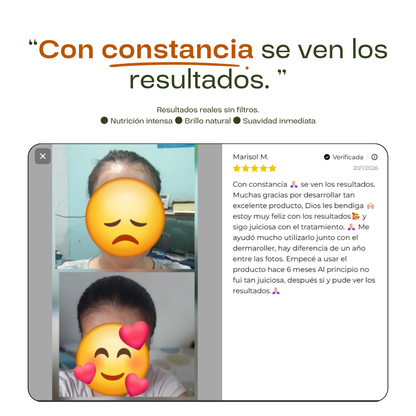 4x Tónico Anticaída - Tratamiento Completo 16 Semanas