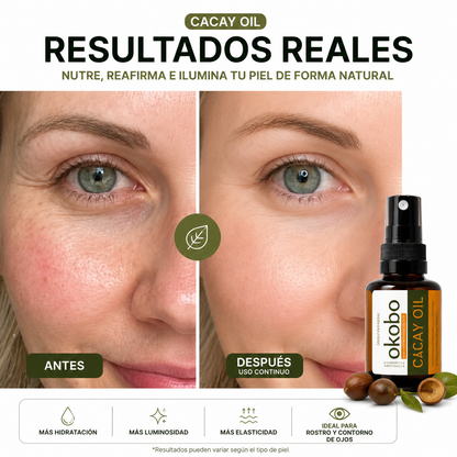 ANTIEDAD NATURAL - Cacay Oil